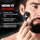Microneedle Derma Roller 0.5mm for Men & Women – Hair Growth